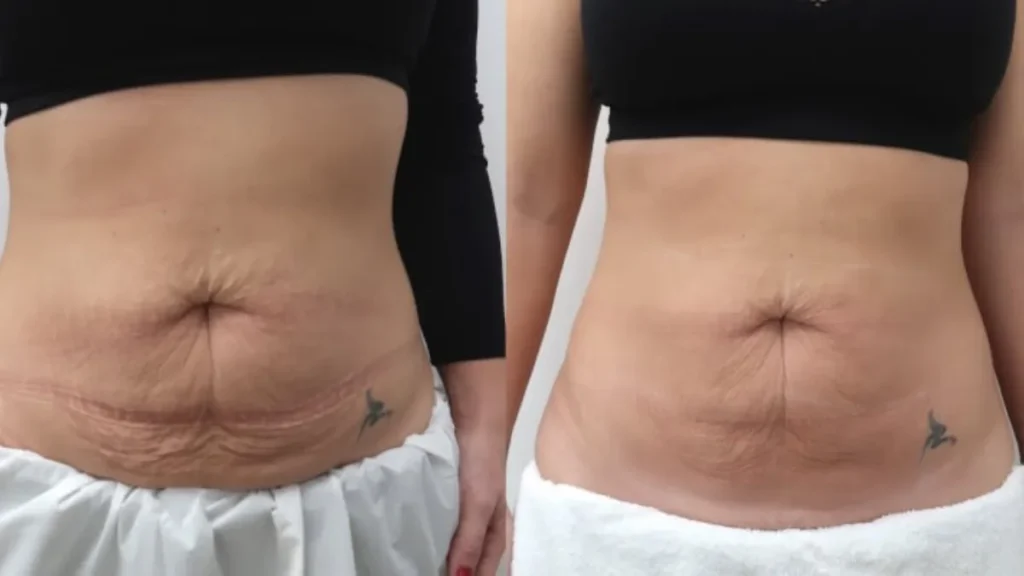 I Lost 5 Kg Without Gym or Diet Here’s What I Changed Daily